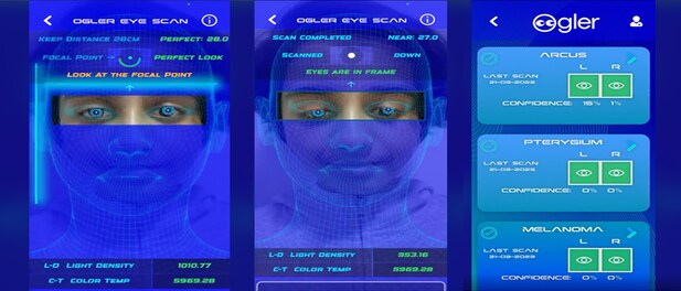11 साल की लड़की का कमाल, आंखों की बीमारियों का पता लगाने के लिए बनाया AI ऐप
