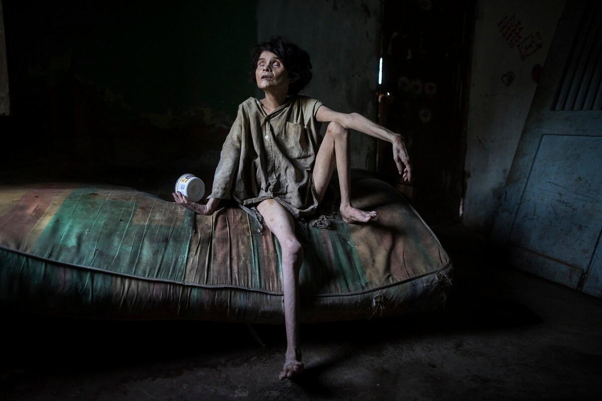 In this Nov. 28, 2019 photo published on Dec. 27, Zaida Bravo, who suffers Parkinson's disease and is malnourished, waits for dinner on her dirty mattress in her one room living quarters in Maracaibo, Venezuela. The 48-year-old's sister Ana Bravo brings her food when she can, but for the last four years the older sister has had trouble affording even rice or cornmeal. "We can't find her medicine or even know how to help her, so we're letting what happens happen," Ana Bravo, 57, said. "Sometimes, I'm afraid to go inside and find her dead." (AP Photo/Rodrigo Abd)