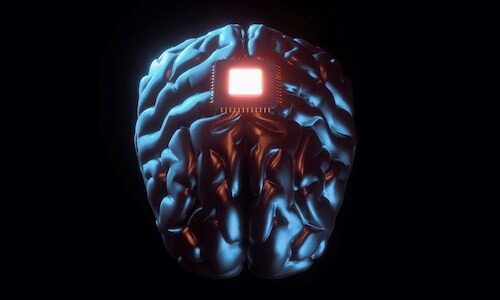 China Joins US in Brain Implant Clinical Trial Success