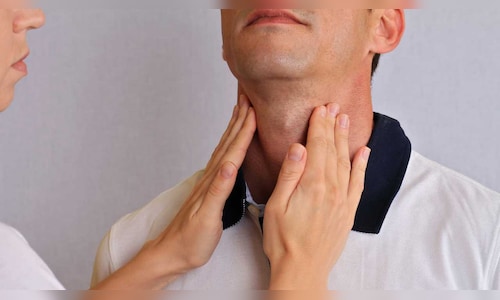 Thyroid Health Breakthroughs: New Treatments Offer Hope for Millions in Ireland