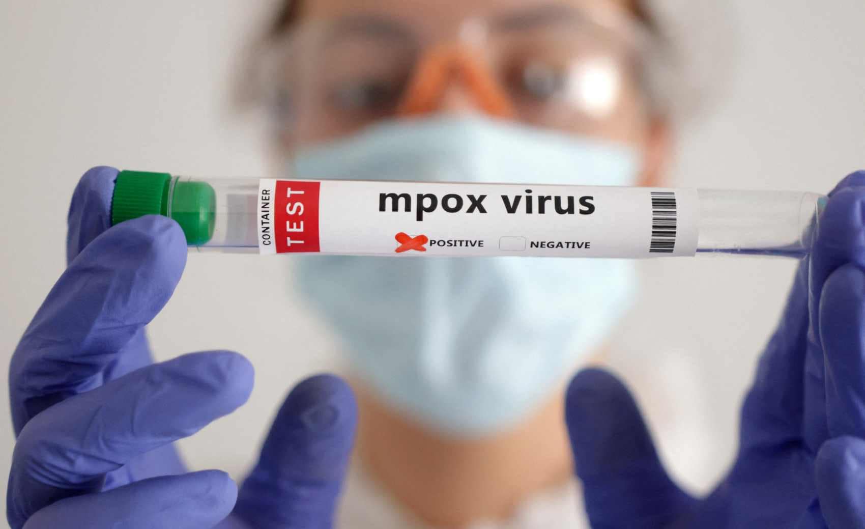 Philippines Says Recent Mpox Case Is Mild Clade 2 Variant - CNBC TV18