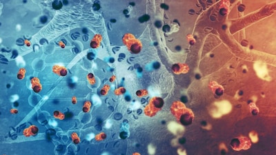 Opening New Medical Frontiers | These discoveries have opened new medical frontiers for treating autoimmune diseases, improving cancer therapies, and preventing complications after transplantations. Regulatory T cells are often found in cancerous tumors, where they may shield the tumor from immune attack. Researchers are exploring ways to overcome this protection. Understanding FOXP3 and regulatory T cells now allows scientists to design therapies that reprogram the immune system to fight cancer or reduce autoimmunity, offering hope for more precise and effective medical interventions. Scientists are also working on genetically modified versions of T cells to promote organ transplant tolerance—the body’s ability to accept foreign tissue from a donor. (Image: Canva)