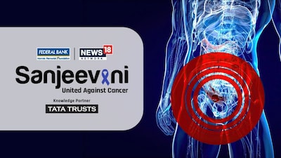 भारत में प्रोस्टेट कैंसर का संकट: कम जागरूकता से देरी से पता चलता है, मेटास्टेटिक मामले बढ़ते हैं.