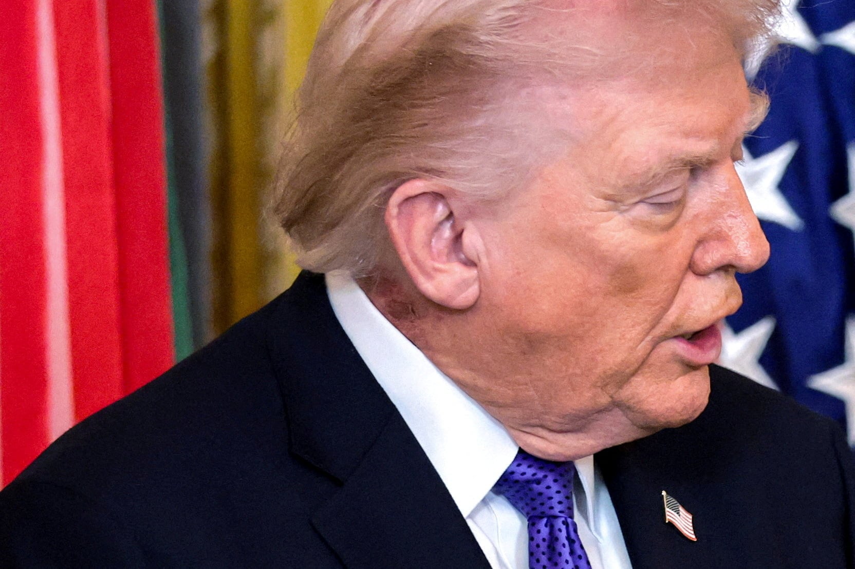 The White House Neck Rash Obsession Proves We Don't Understand Modern Dermatology