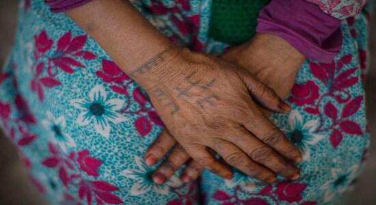 In Morocco, Tribal Tattoos Fade With Age, Islam