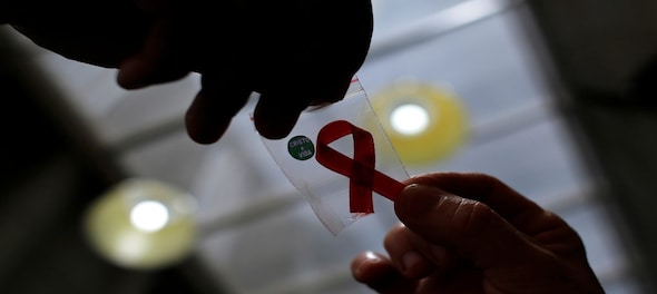 India cut 84% TB deaths in AIDS patients by 2017