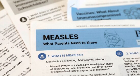 Should Measles vaccine be given at 6 months instead of 9 for infants?