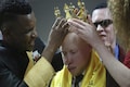 Albinism pageant in Zimbabwe joyfully breaks down prejudice