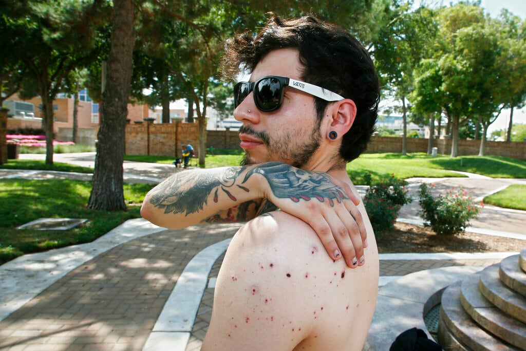 Daniel Munoz reaches for his injured back during an interview, Sunday, Sept. 1, 2019, in Odessa, Texas. Munoz was injured in Saturday's shooting. The tattoo on his right hand is a biblical reference, that the wages of sin are death and God's gift is everlasting life. (AP Photo/Sue Ogrocki)