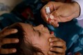 Polio vaccine: 12 Maha kids given hand sanitiser drops instead of polio dose