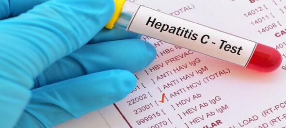 Explained: What is Hepatitis C?