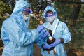 Bird Flu: Animal husbandry secy says poultry is safe to consume, advises states to desist from banning
