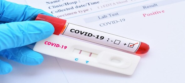 Coronavirus in India: Over 16,000 new COVID cases recorded, positivity rate at 5.44%