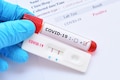 New test can tell how much immunity you have against COVID-19