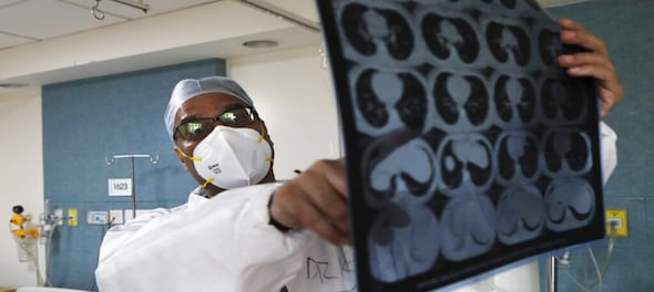 This AI-based X-ray test can detect COVID-19 WITH 98% accuracy; here's how