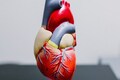 US surgeons transplant pig heart into human patient