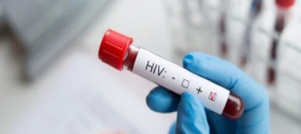 Delhi: High court directs govt to provide free food, treatment to HIV-positive persons