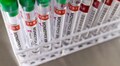 WHO says no evidence monkeypox virus has mutated