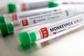 Monkeypox in India: From designated hospitals, vaccine status to guidelines for flyers