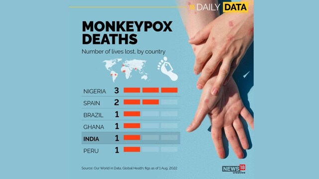 India reports 9 monkeypox cases, 1 death — List of states where ...