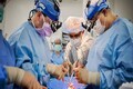 Two pig heart transplants succeed in brain-dead recipients in US