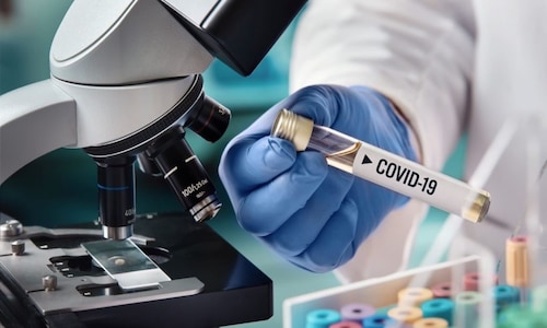Coronavirus in India: Over 10,000 new COVID-19 cases recorded, 36 deaths reported