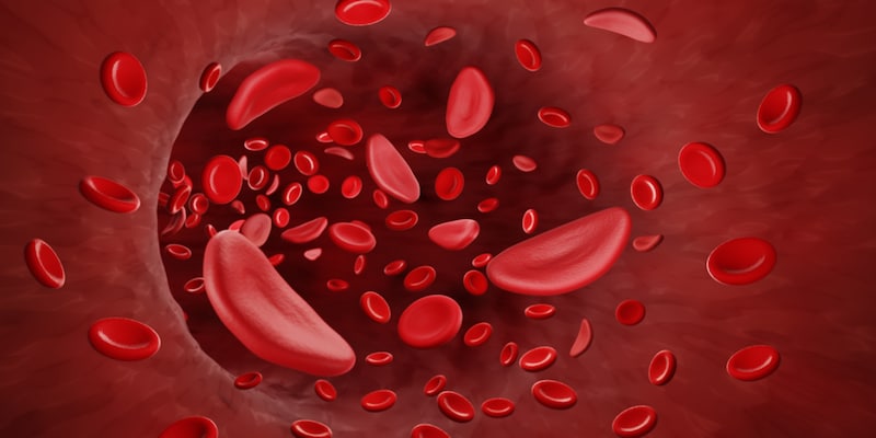 India is going to screen 70 million people in its fight against sickle cell anaemia