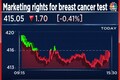 Zydus Lifesciences bags marketing rights for OncoStem's new breast cancer test