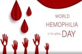 World Hemophilia Day 2023: Date, theme, importance and all you need to know