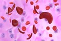 India releases new sickle cell anaemia guidelines — here’s all you need to know