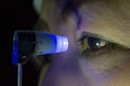 Rare eye diseases in India: How genetic testing can help manage it
